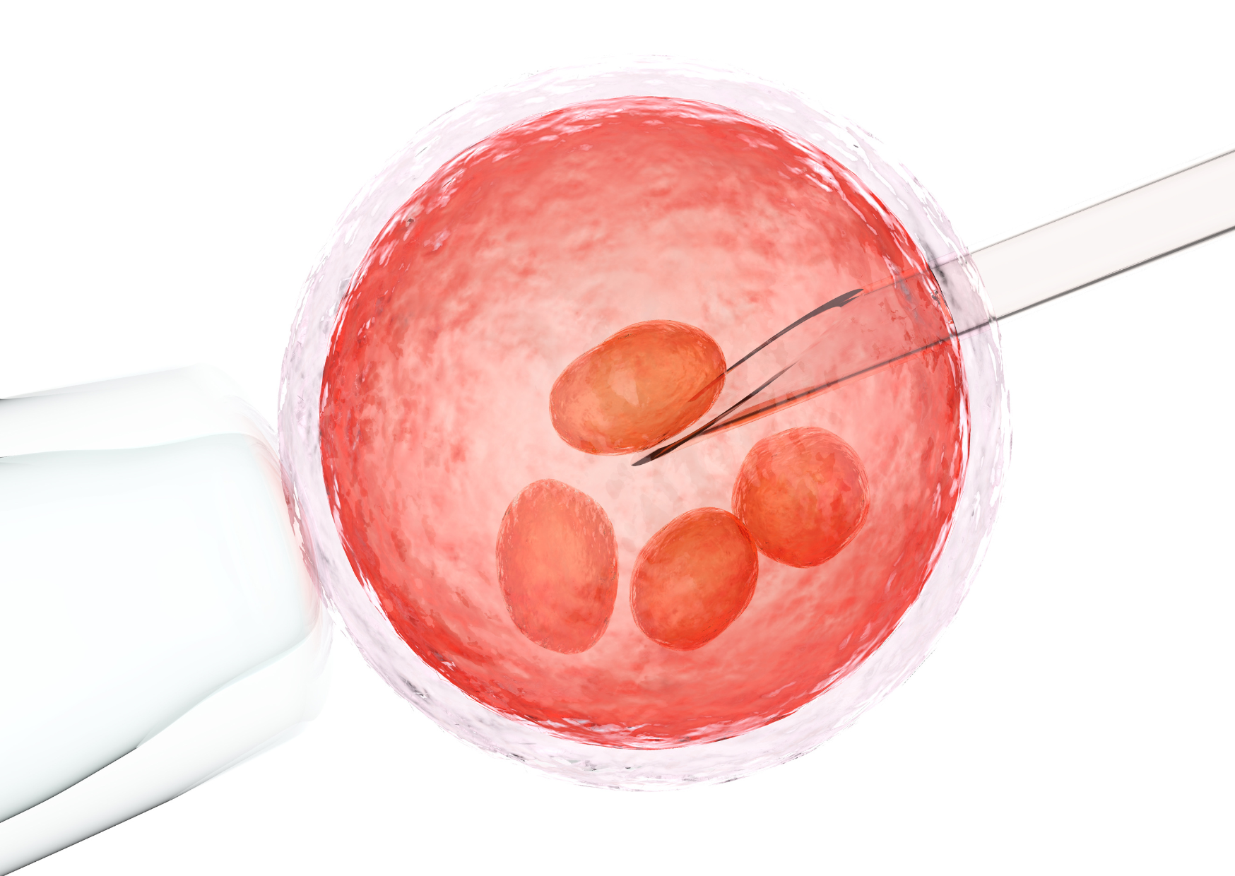 pgd doenças genéticas